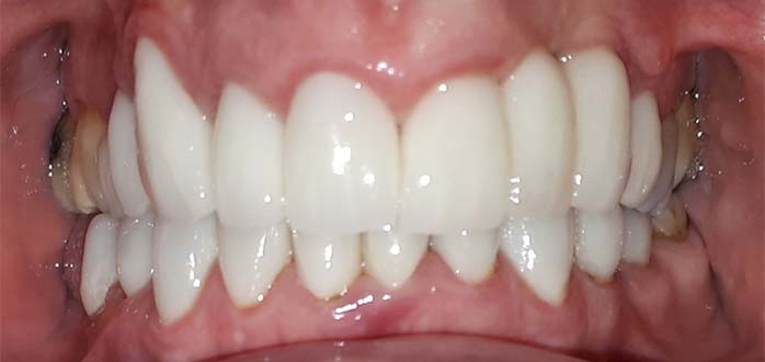 After - Marlborough Dental