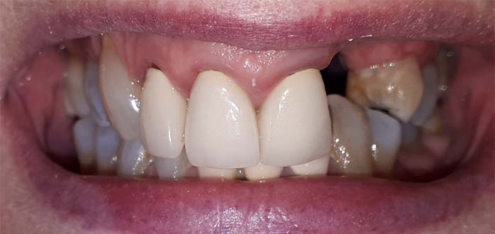 Before - Marlborough Dental