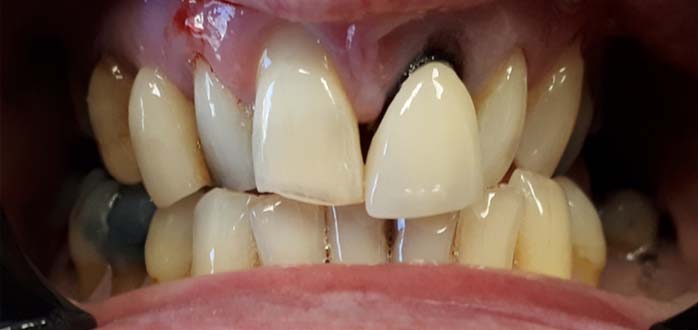 Before - Marlborough Dental