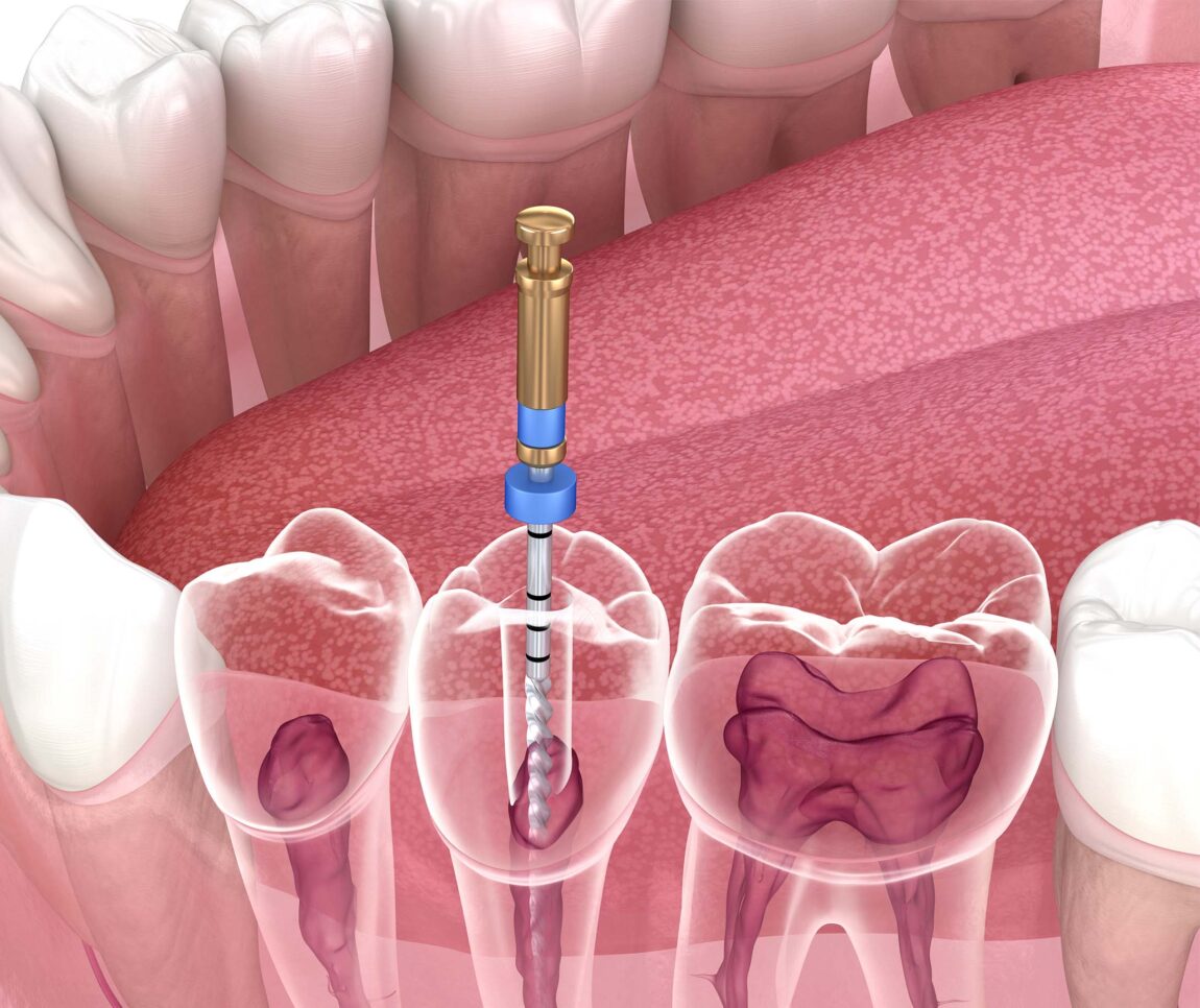 Treatment - Marlborough Dental