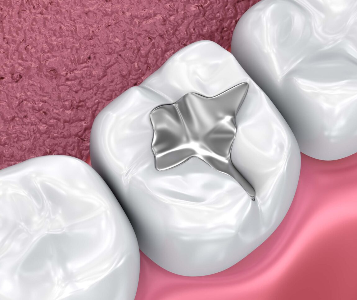 Treatment - Marlborough Dental